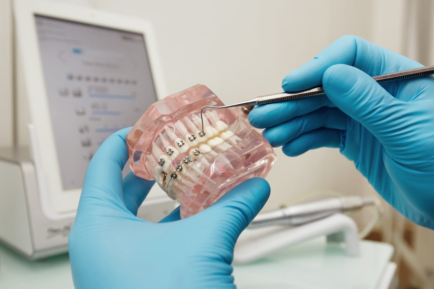 aidite-vs-formlabs-dental-resin-which-is-better-for-dentistry