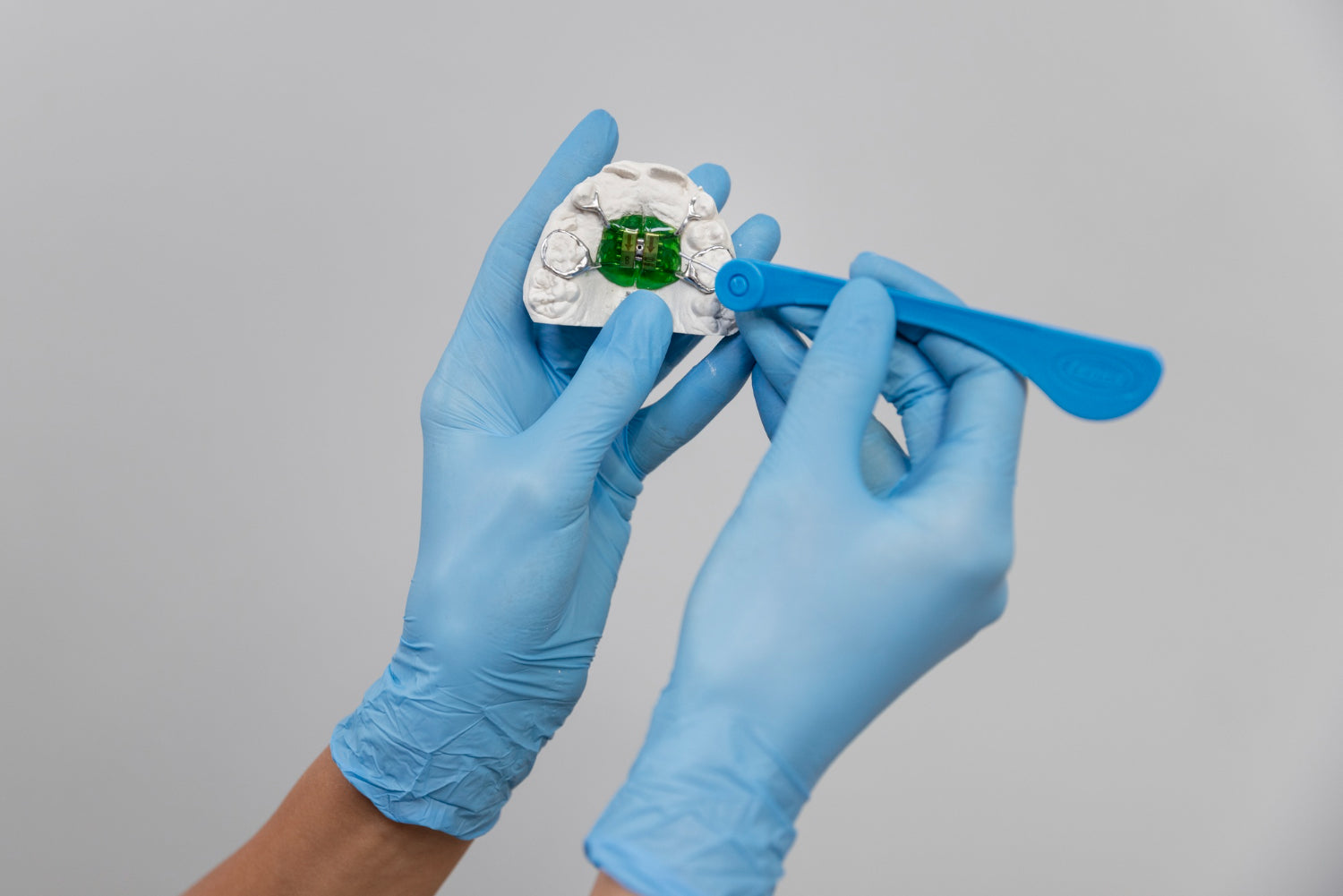 What Is Dental Resin for 3D Printing A Beginner’s Guide