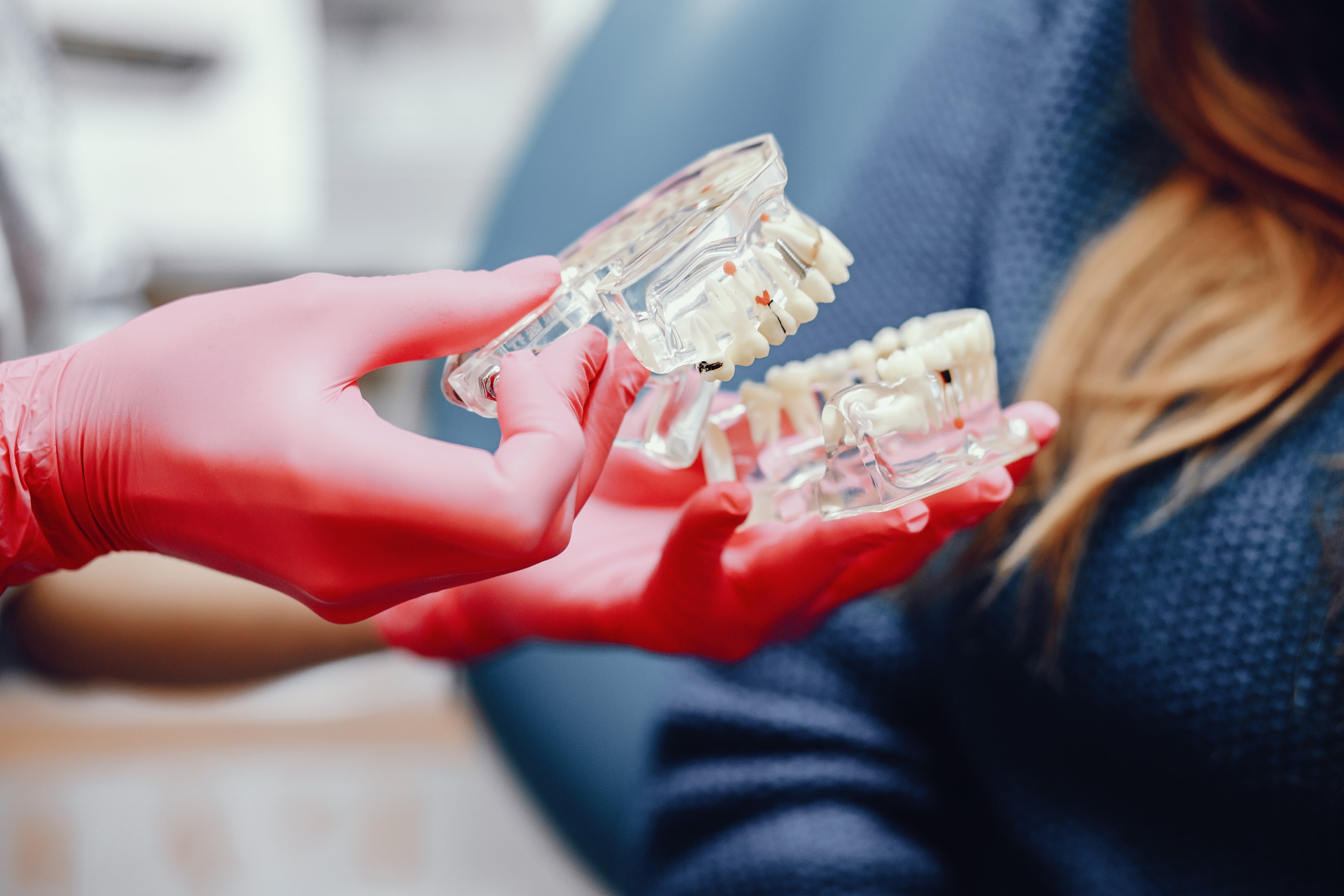 Hard clear dental splint resin jaw model