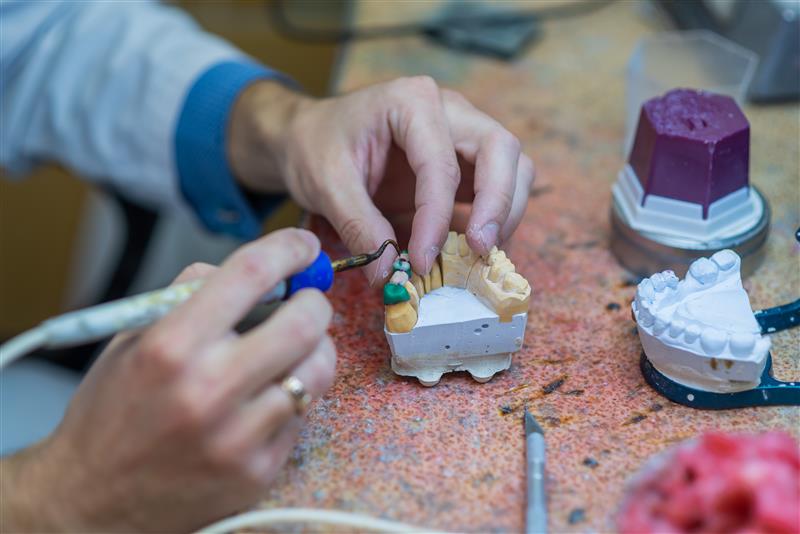 Dental bridge fabrication process