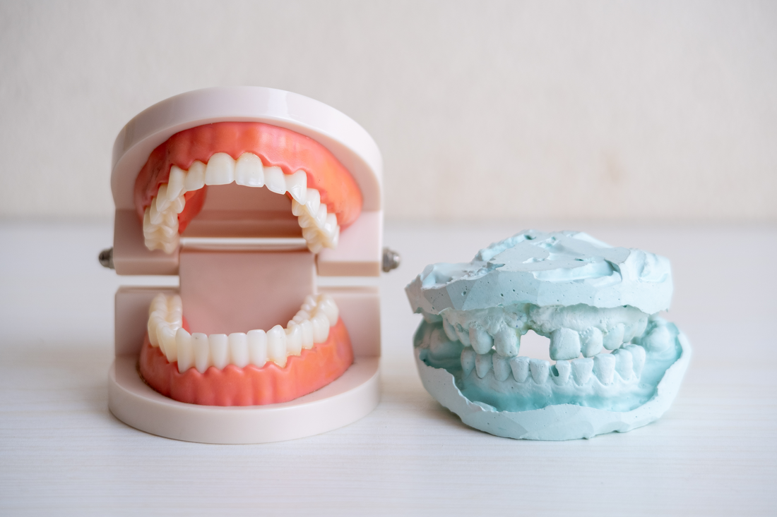 Understanding the Different Zirconia Restorations
