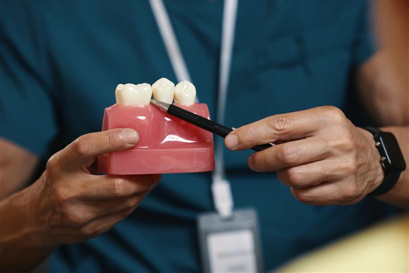 Types of Dental Crowns Explained 