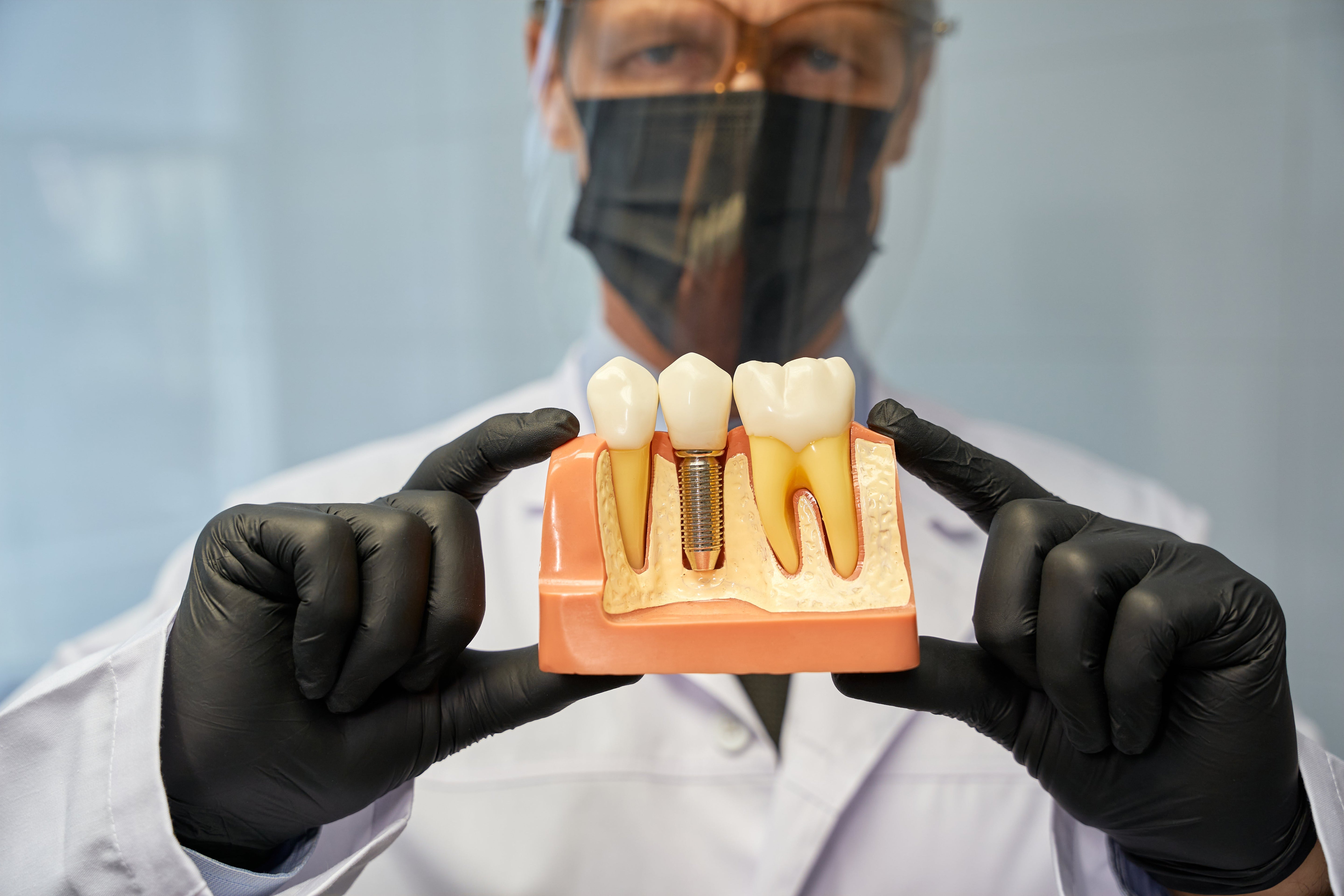 Dental implant and crown restoration model